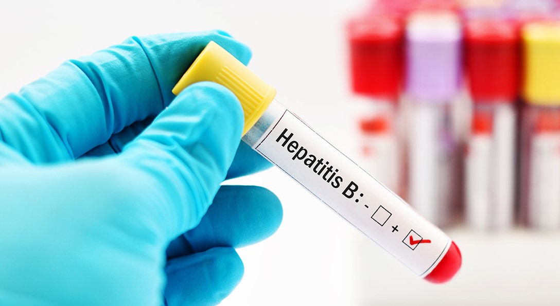 ÃÂÃÂ°ÃÂÃÂÃÂ¸ÃÂ½ÃÂºÃÂ¸ ÃÂ¿ÃÂ¾ ÃÂ·ÃÂ°ÃÂ¿ÃÂÃÂ¾ÃÂÃÂ hepatit b